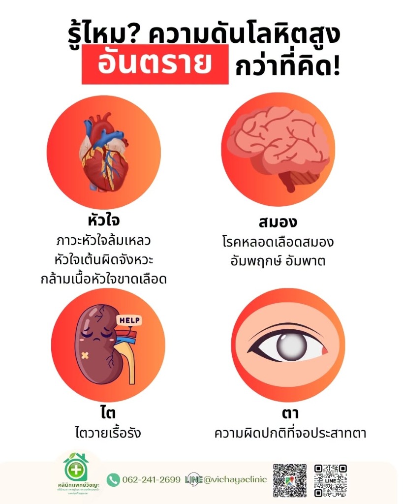 อินโฟกราฟิก รู้ไหมความดันโลหิตสูงอันตรายกว่าที่คิด ส่งผลต่อหัวใจ สมอง ไต และตา คลินิกแพทย์วิชญะ