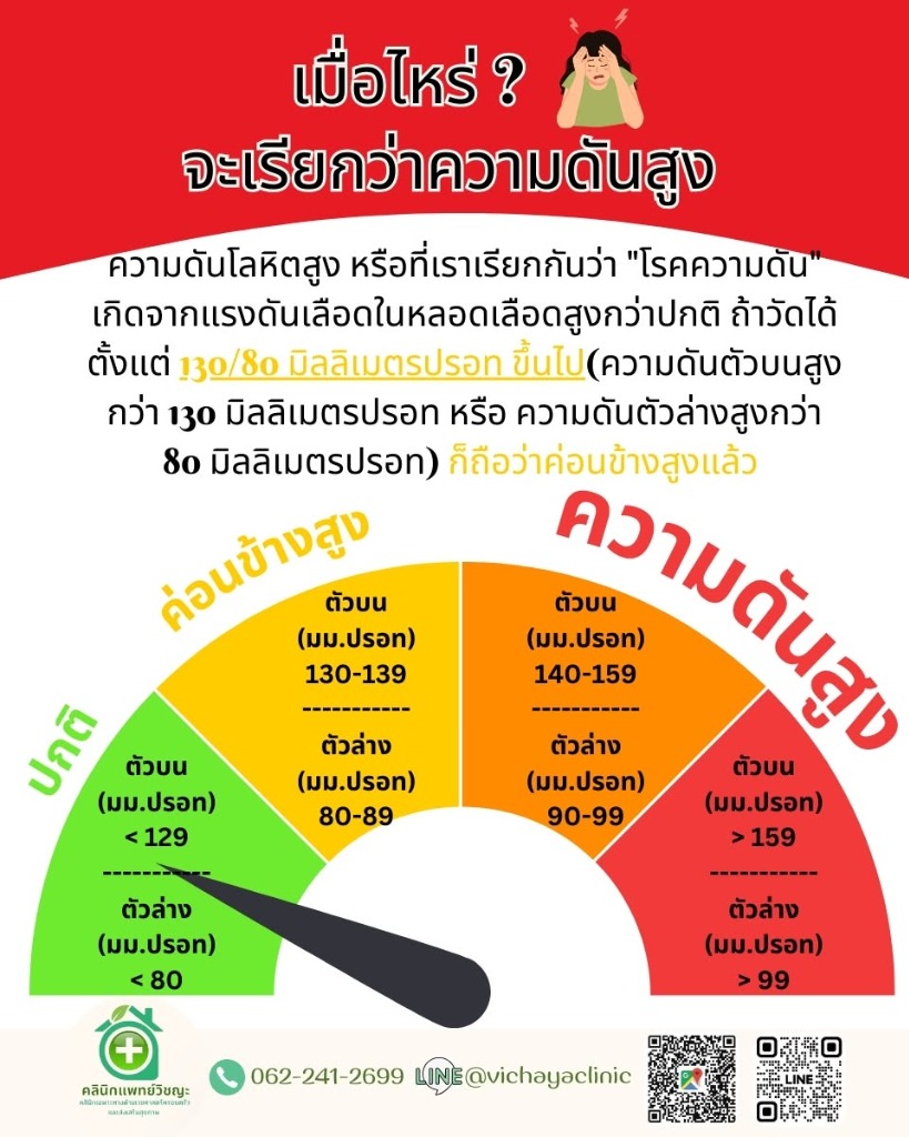 อินโฟกราฟิก เมื่อไหร่จะเรียกว่าความดันสูง แสดงเกณฑ์ความดันปกติ ค่อนข้างสูง และความดันสูง หน่วยมิลลิเมตรปรอท โดยคลินิกแพทย์วิชญะ